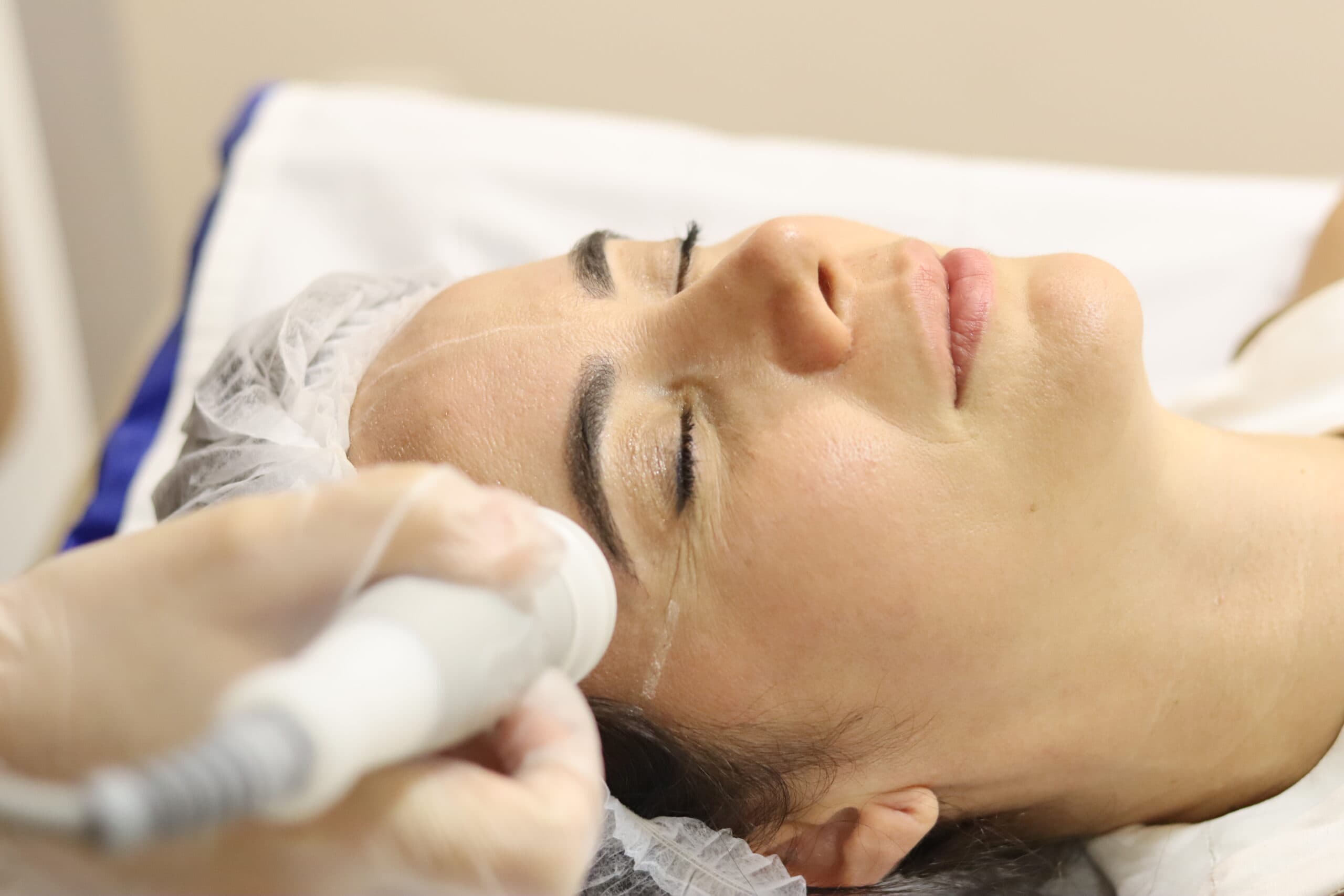 Radiofrequência Facial