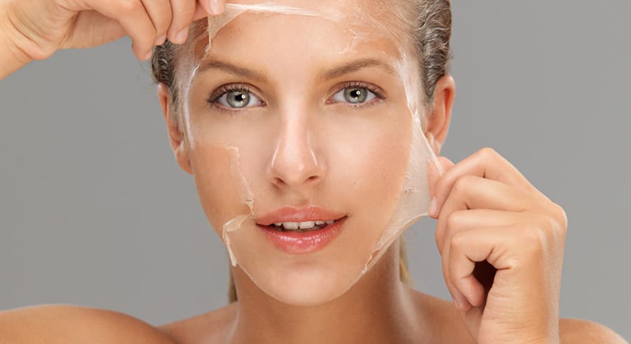 Peeling Quimico